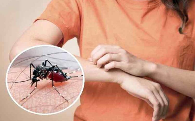  बढ़ते डेंगू के मामलों को लेकर स्वास्थ्य विभाग ने जारी की एडवाइजरी,पेनकिलर दवा नहीं लेने का दिया सलाह